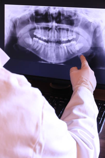 Best Emergency Treatment for Dental Infections or Abscesses in The Hideout, PA
